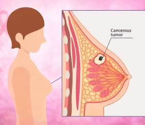 breast-cancer-awareness