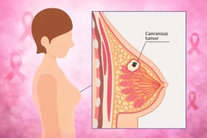 breast-cancer-awareness