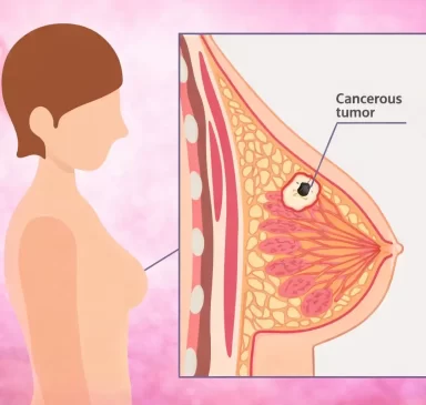 breast-cancer-awareness