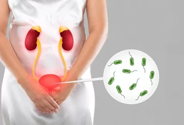 chronic-urinary-tract-infection-in-women